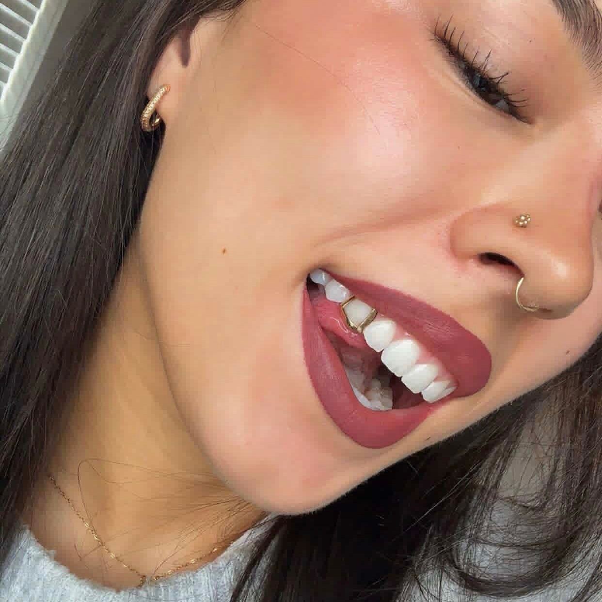 Single Open Faced Gold Cap