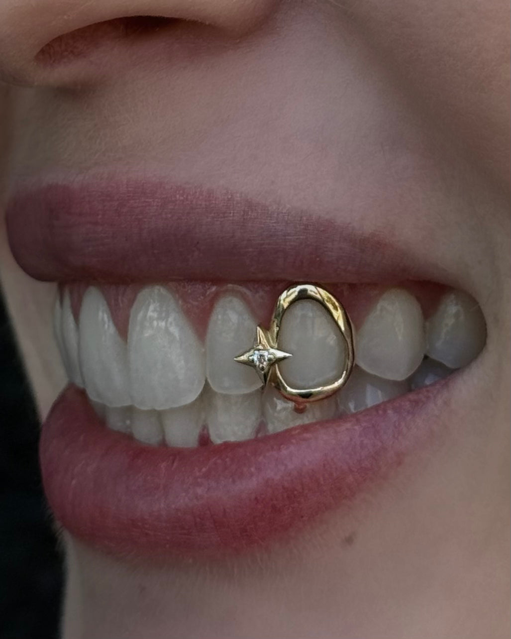 Open Face Starburst Cap