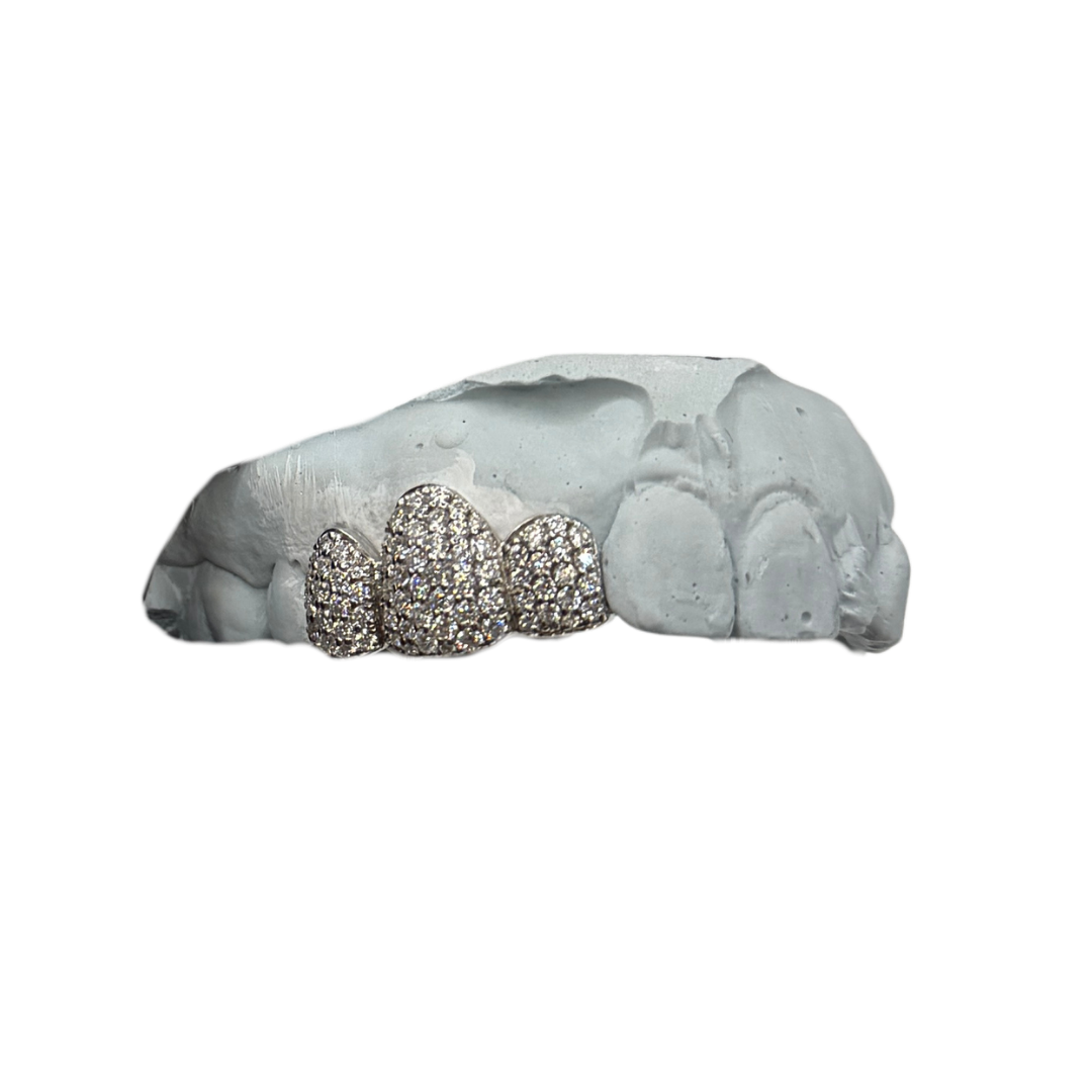 Fully Iced Fronts Grillz (4–10 Teeth)