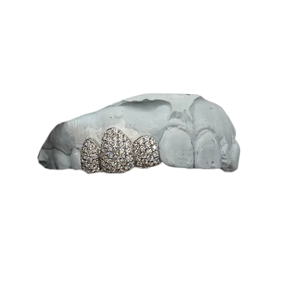 Fully Iced Fronts Grillz (4–10 Teeth)