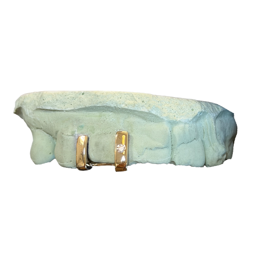 Double Gap Filler w/ Single Stone