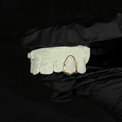 Single Open Faced Gold Cap