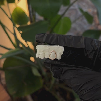 Single Open Faced Gold Cap